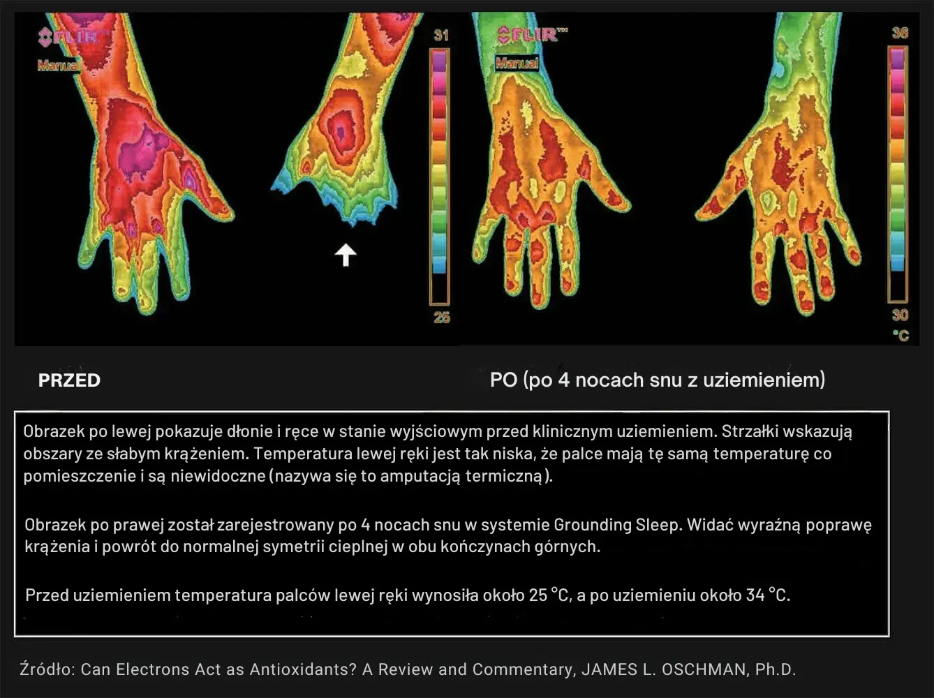 Co nauka mówi o uziemieniu
